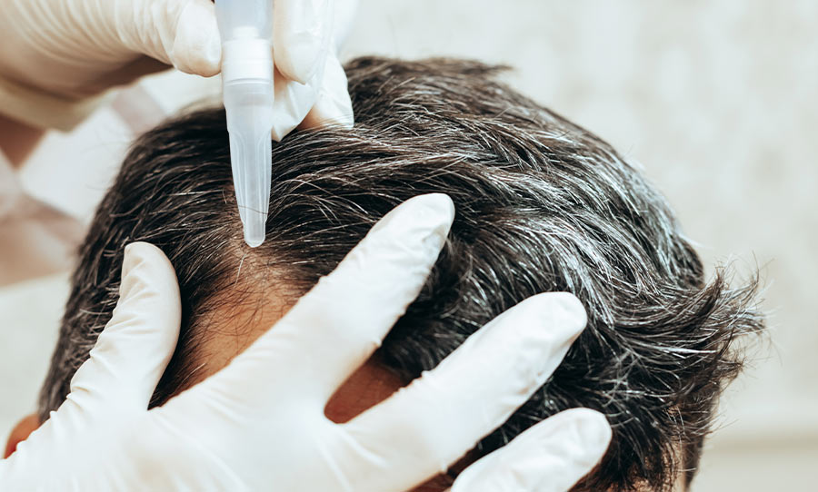 Hair Transplant | Plastic Surgery India Hair Transplant | Plastic Surgery India