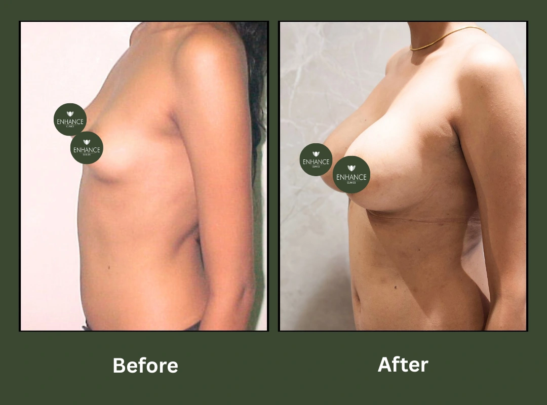 Transformation-1 Transformation-1