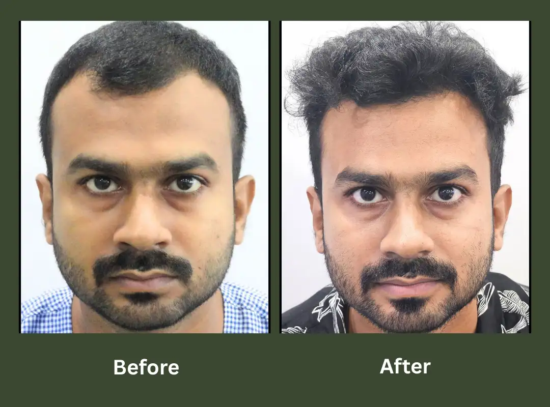 Transformation-2 Transformation-2