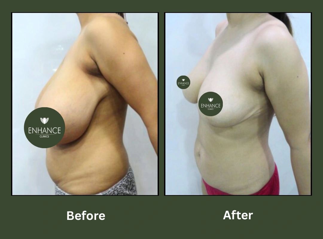 Transformation-3 Transformation-3