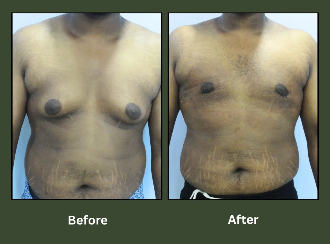 Transformation-4 Transformation-4