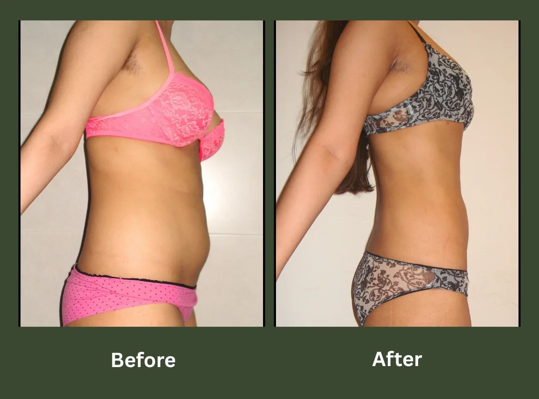 Transformation-5 Transformation-5