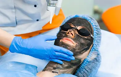Carbon Photo Facial