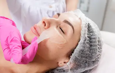 Chemical Peeling