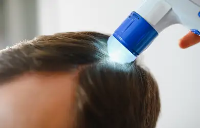  Laser Hair Rejuvenation